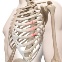 InjuredRibs InjuredRibs