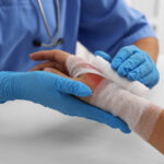 Injured_Burn3